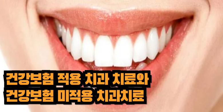 치과 보험적용, 보험 미적용